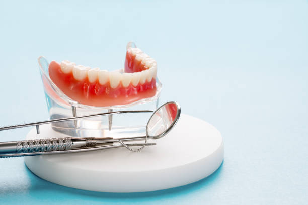 Dental Inlays and Onlays in Alpena, MI